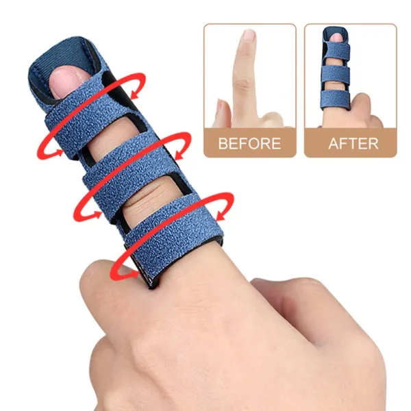 Adjustable Trigger Finger Splint Support Brace - Image 3