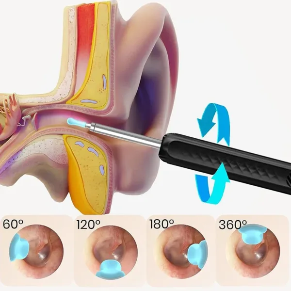 Wireless WiFi Ear Cleaner Otoscope Kit - Image 6