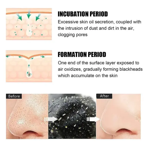 Bamboo Charcoal Blackhead Removal Stick - Image 3