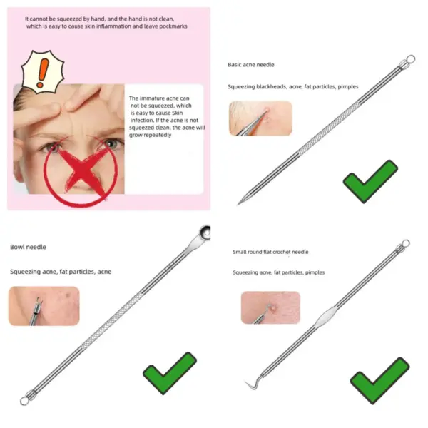 4PCS Stainless Steel Blackhead Remover Set - Image 4