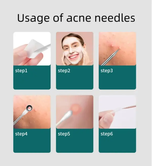 4PCS Stainless Steel Blackhead Remover Set - Image 6