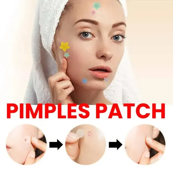200pcs Acne Repair Patches for Clear Skin - Image 5