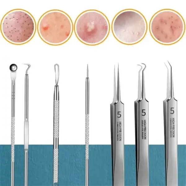 11Pcs Blackhead Removal Tool Kit - Image 3