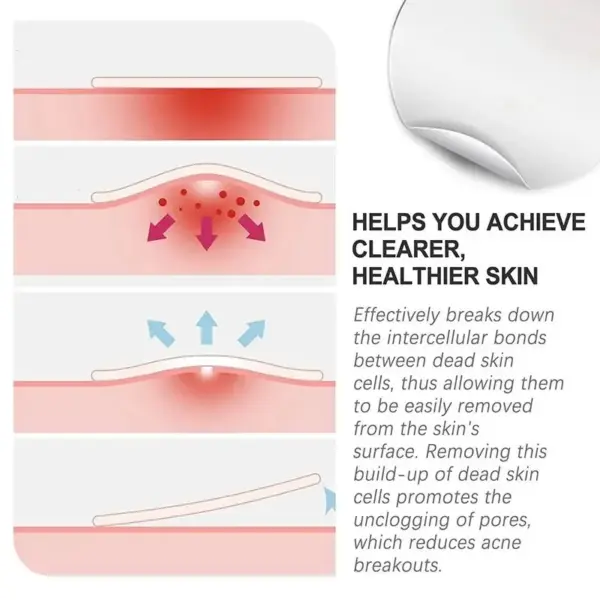 72pcs Invisible Acne Patch for Flawless Skin - Image 5