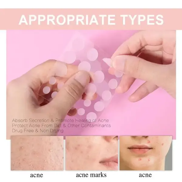 72pcs Invisible Acne Patch for Flawless Skin - Image 3
