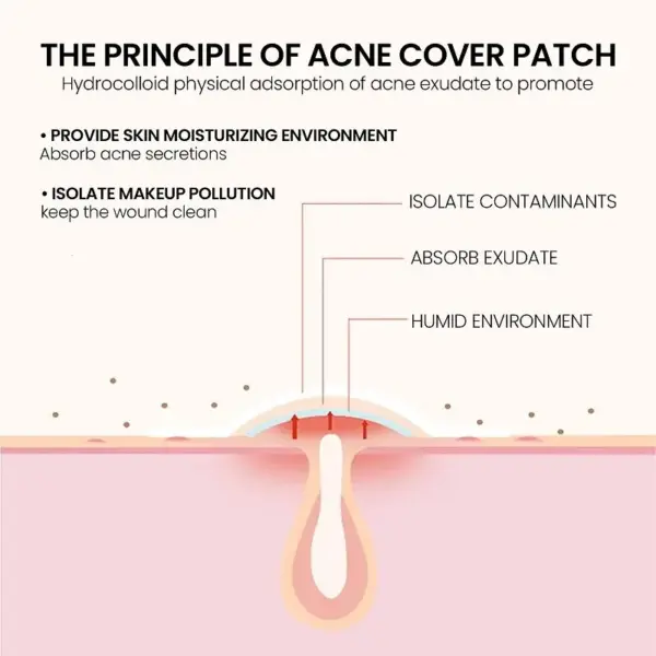 200pcs Acne Repair Patches for Clear Skin - Image 4