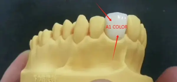 Resin Temporary Dental Crown A1 A2 85D Hardness - Image 2
