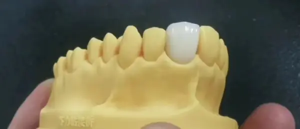 Resin Temporary Dental Crown A1 A2 85D Hardness - Image 5