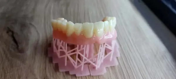 Resin Temporary Dental Crown A1 A2 85D Hardness - Image 4