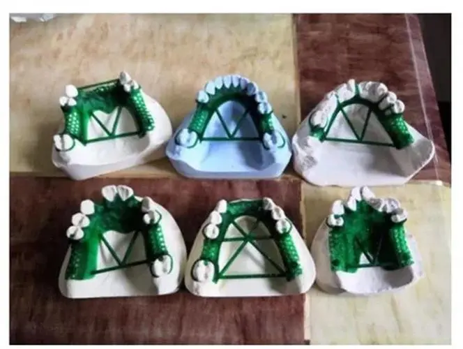 Dental Casting Resin for 3D Printing 500g/200g 4 Dental Casting Resin for 3D Printing 500g/200g - Image 4