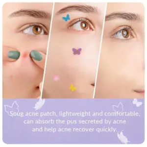 Butterfly-Shaped Acne Pimple Patch Set (120-360 pcs) 12 S2550b1f2c0d84e74bb9a9dfedeaac2c1U