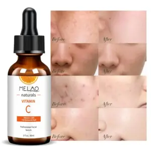 Vitamin C Brightening Serum with Hyaluronic Acid 20% 10 Sd0f7090f0ef6468eab0a46907d47ecbdP