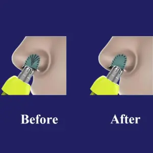 Vibrant Yellow & Silver Nose Hair Trimmer 13 S0feb2bb4a4d14c1b9869e7753501231b8