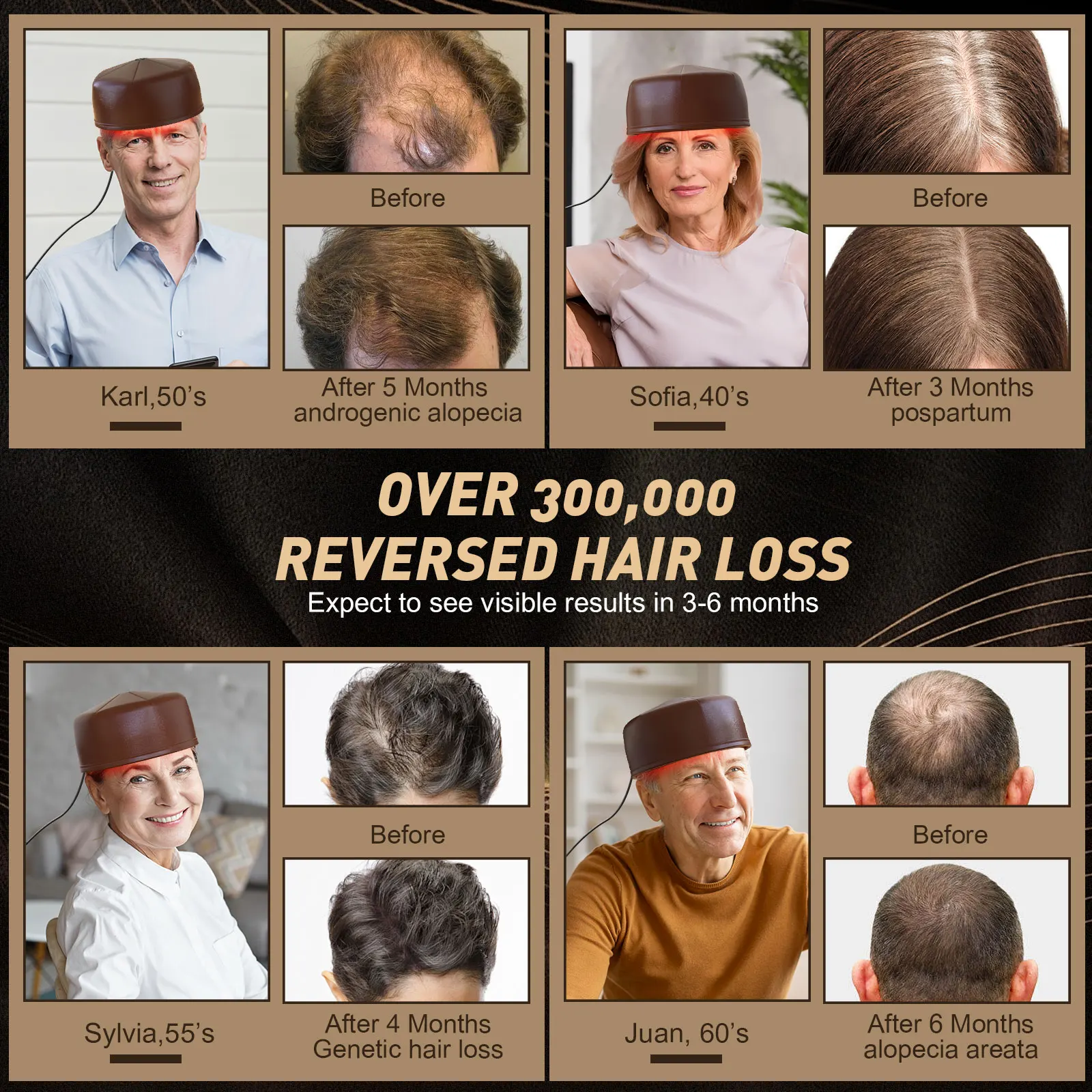 Infrared Hair Growth Cap with 120 Diodes 5 Infrared Hair Growth Cap with 120 Diodes - Image 5