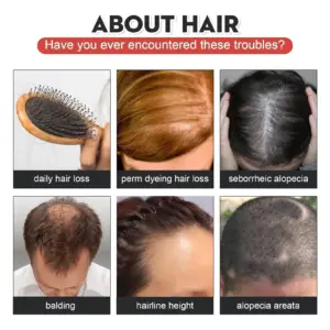 S179811baac26451b99a4d2633fe03518P