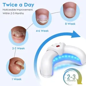KTS Semi-arc Nail Fungus Laser Device 11 S416bdc9ff7fe44e29d3c0665047fe03fc