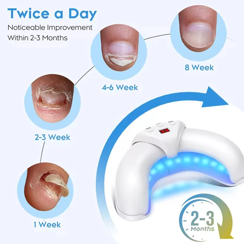 KTS Semi-arc Nail Fungus Laser Device 5 KTS Semi-arc Nail Fungus Laser Device - Image 5