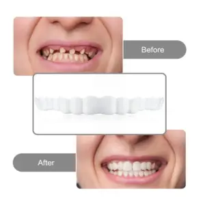 Set of 4 Adjustable White Dentures for Upper and Lower Jaws 10 S551c8d9a832d464fb0cc5b1725966cdfy