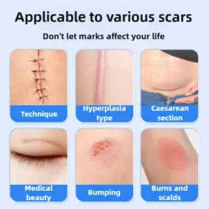 S81f18185d51248a48e7d8b306ecb3184e