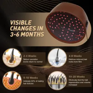 Infrared Hair Growth Cap with 120 Diodes 9 Saefbfdf4b39442dc8ab8c07399ad97b8t