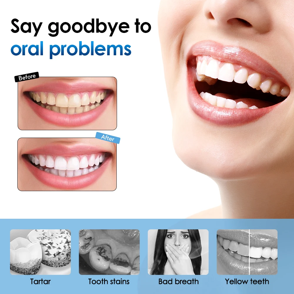 White Electric Toothbrush with 31,000 VPM 4 White Electric Toothbrush with 31,000 VPM - Image 4