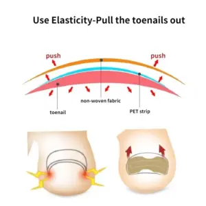 Foot Care Set with Nail Correction Patches 13 Sc2b78c53405c40d2869e52aad51941aaa
