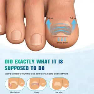 Foot Care Set with Nail Correction Patches 10 Sef0298c3b8374880a5bed859c4e2a22aw