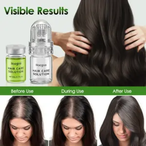 Hair Growth Serum with Micro Needle Roller Kit 10 S5848e7f7049443f59606a0e26f5a6829P