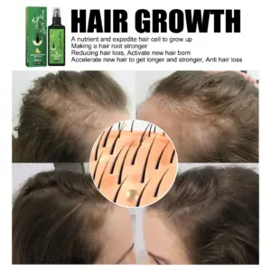 South Moon Hair Growth Spray 100ml 10 S69a14d63065c4dd69f367b3d744be3b6K