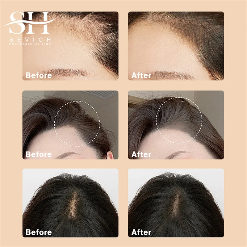Waterproof Hairline Powder for Quick Touch-Ups 4 Waterproof Hairline Powder for Quick Touch-Ups - Image 4