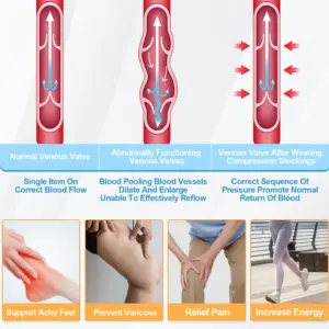 White Support Thigh-High Compression Stockings 11 Saf58fb56ef444319a5138697e4cb1081R