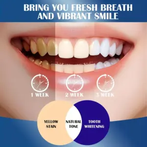 Sbd4ecba1bba3491289f3cdff7dcb9237i