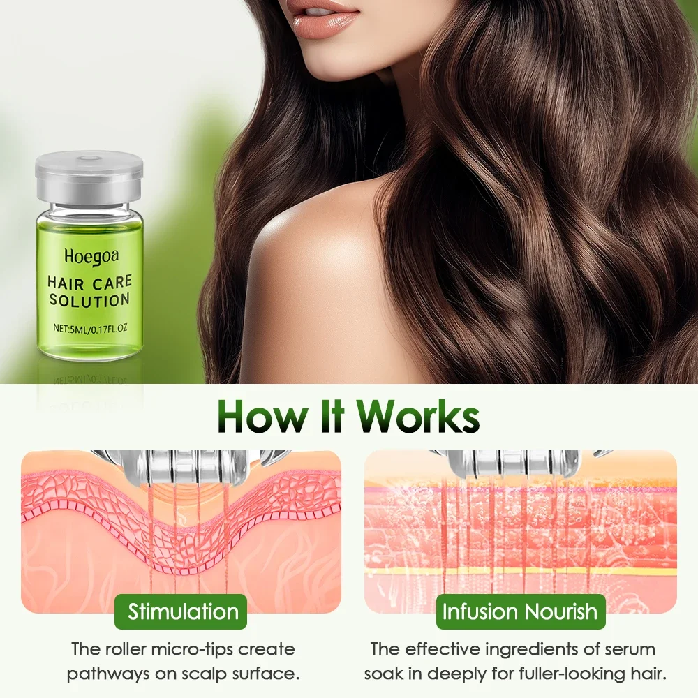 Hair Growth Serum with Micro Needle Roller Kit 2 Hair Growth Serum with Micro Needle Roller Kit - Image 2