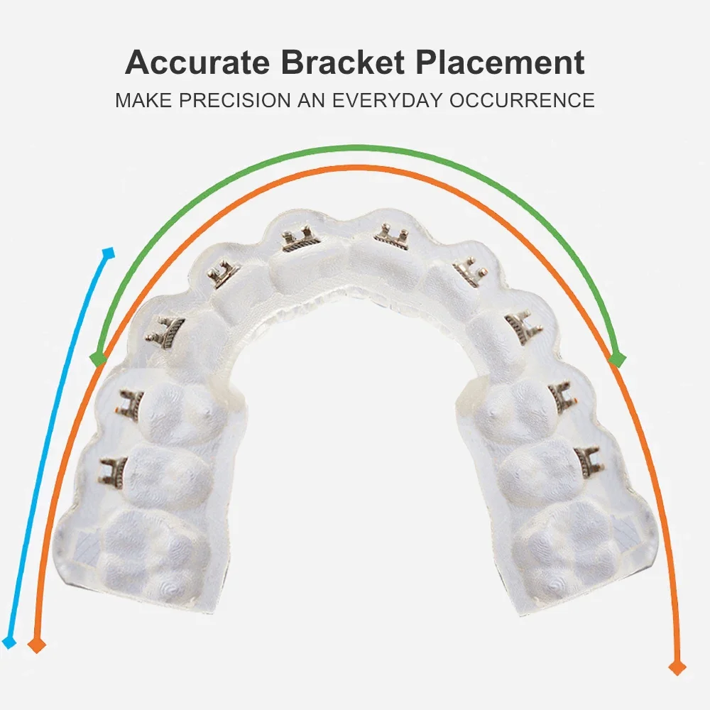 Transparent Silicone Impression Material 50ml 4 Transparent Silicone Impression Material 50ml - Image 4