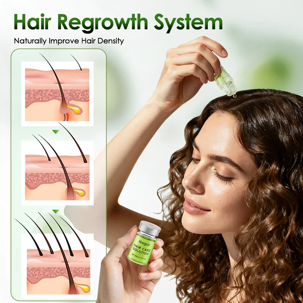 Hair Growth Serum with Micro Needle Roller Kit 3 Hair Growth Serum with Micro Needle Roller Kit - Image 3