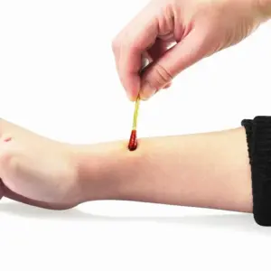 Disposal Cotton Swabs Set for First Aid 9 Se886f25d51b841598a2202033ef45feb0