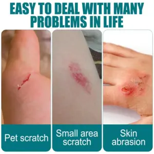 Waterproof Liquid Bandage Gel 10ml with Brush 12 Sfc7d17fe14b445a194f0c9b7f5fb157e4